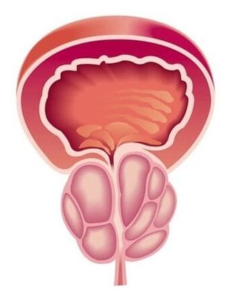Příznaky prostatitidy u mužů