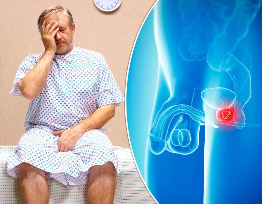 Muž s prostatitidou podstoupí diagnózu onemocnění